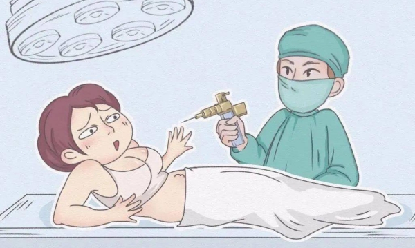 万晓楠3s人鱼体雕适合人群