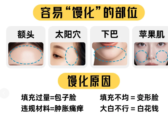   珠海新颜整形馒化脸修复超赞，院长亲诊审美在线术后自然不假面