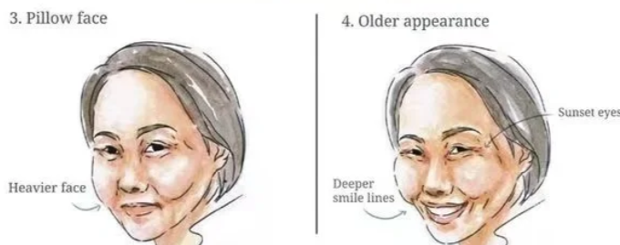 为什么黎星脂肪修复价格比普通填充贵?