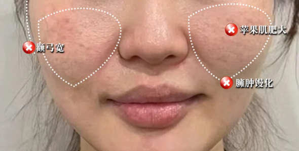 选黎星医生还是其他医生?真实实例对比帮你避坑