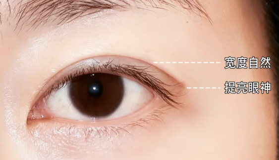 上海做双眼皮修复为什么选悦欧？