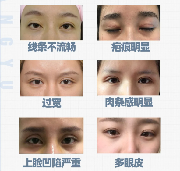 上海悦欧医疗美容在双眼皮修复方面确实有优势