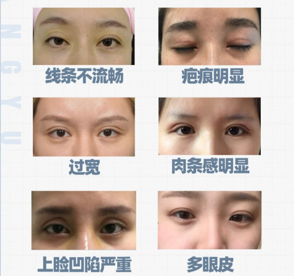 上海悦欧医疗美容是渠道医院?不是!卫健委认证正规机构,中高端医美选它不踩坑