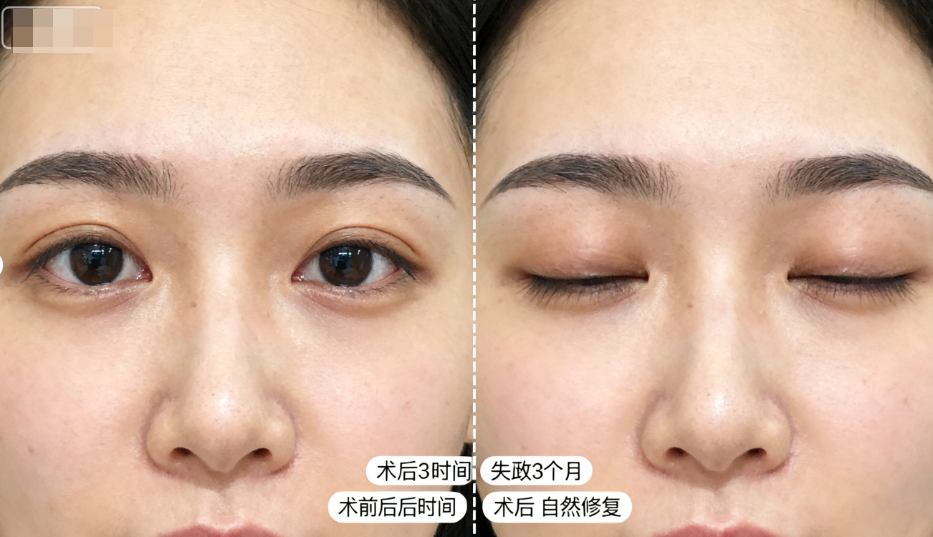 梁伟中医生手术