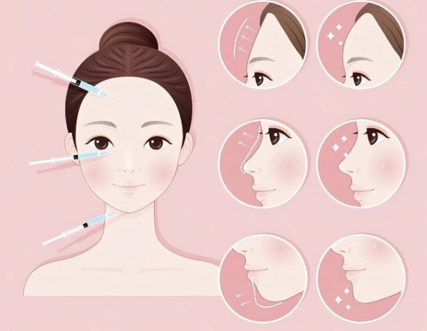 馒化修复实例分享