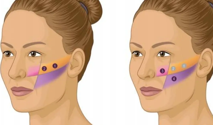 如何科学选择馒化修复方案