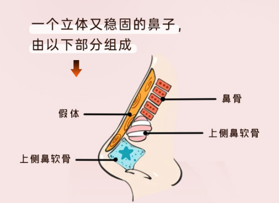 文丰做鼻子都是肋骨鼻吗