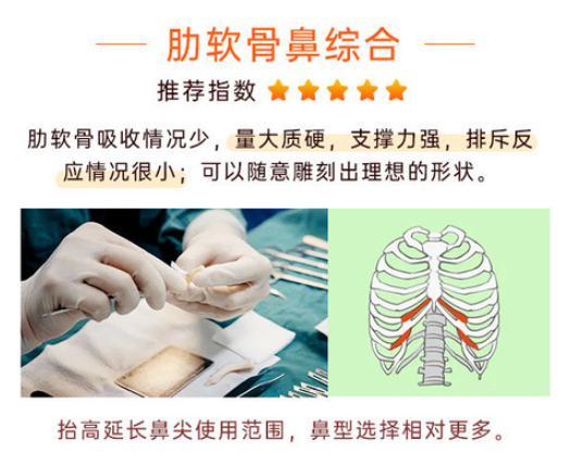 文丰做鼻子都是肋骨鼻吗