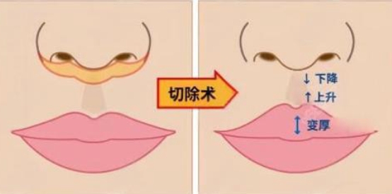 李泽人中缩短医生在哪个医院坐诊