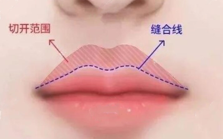 李泽医生在重庆坐诊医院地址