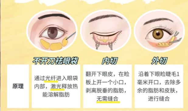 杭州健丽的不开刀去眼袋变好，到底靠什么