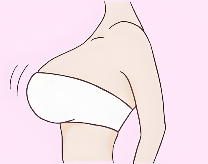 广州唐志荣隆胸好不好呢