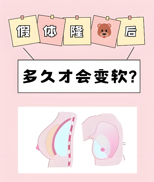 整形李高峰是专攻胸部整形吗？是的几十年临床经验靠谱，医生亲述假体与脂肪复合丰胸适合哪些人