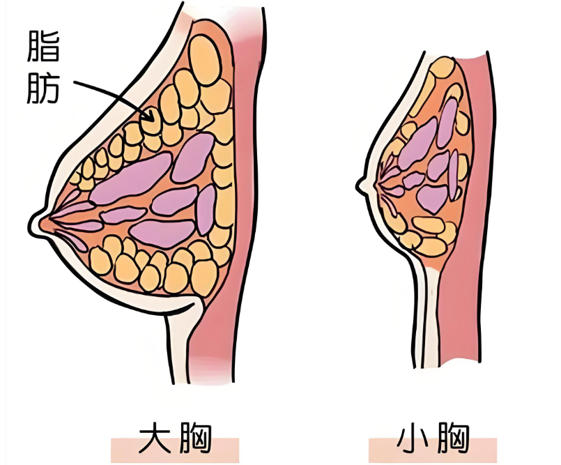 李高峰隆胸怎么样