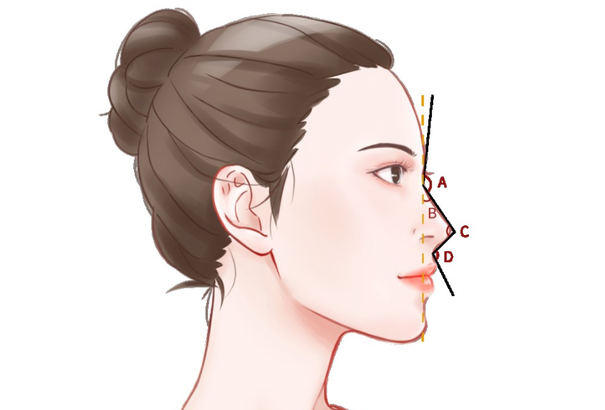 广州鼻整形医生王宏伟在哪家医院?坐诊信息在广州瑰丽诗医疗美容,都夸他做自然美鼻技术好