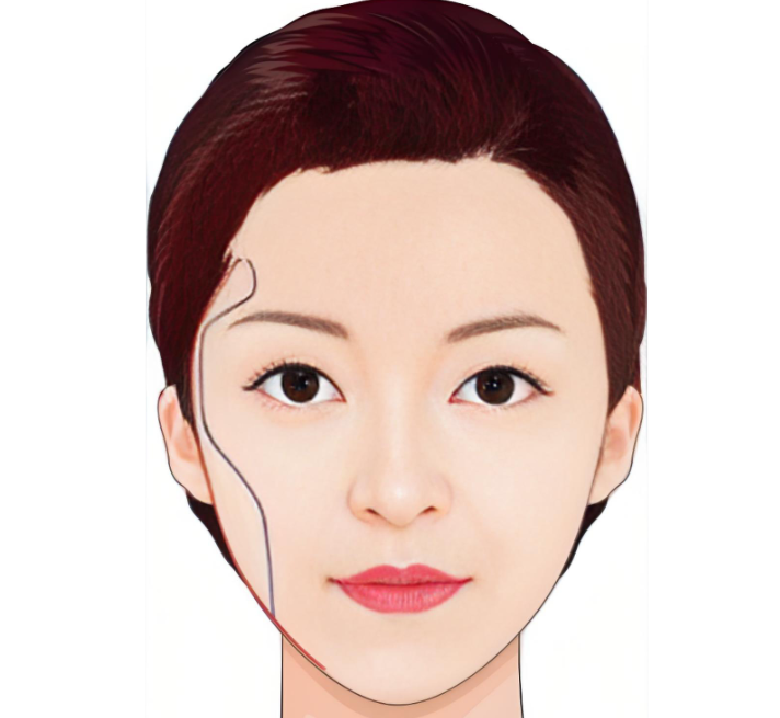 广州沈绍勇改脸型如何