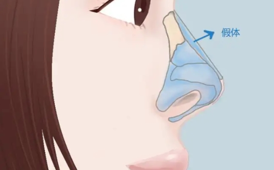 文丰是正规鼻整形医生吗