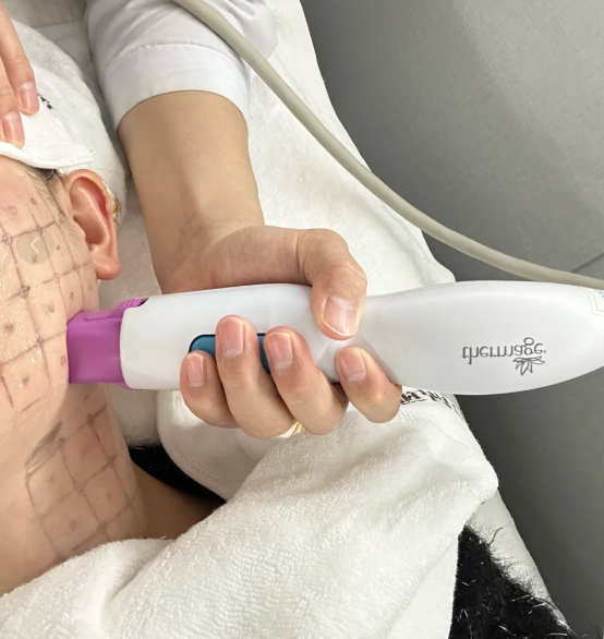 杭州星纪医疗美容院价格:濡白天使4599元起,黄金超光子疗程卡更划算