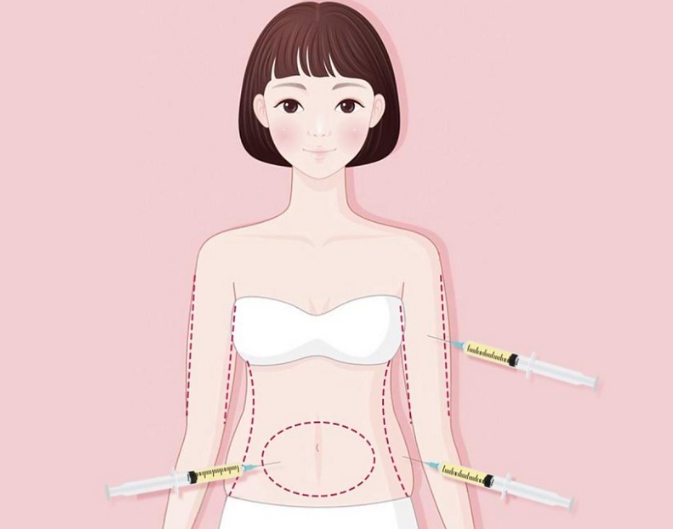 上海安禾美阁抽脂出名的医生:李宁处理腰腹脂肪、刘玉钊做大腿环吸、陈文龙擅面部脂肪雕刻