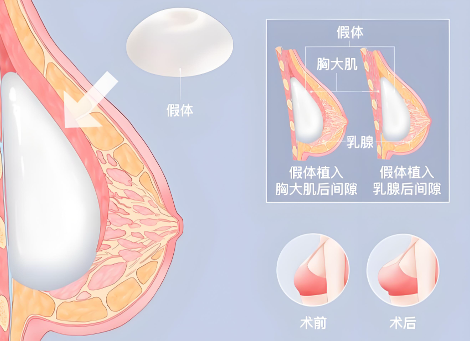 唐志荣做胸www.aimei.com