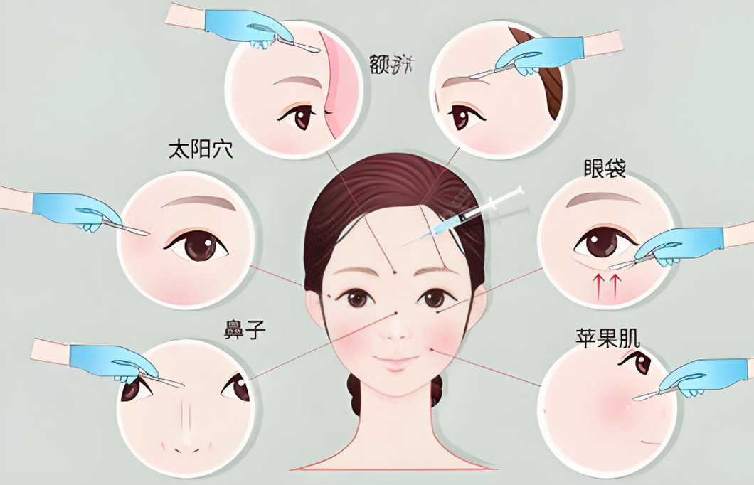 广州彭栋梁取异物好不好