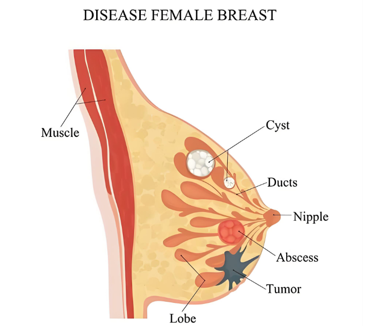 广州郝永生胸部下垂矫正术价格www.aimei.com