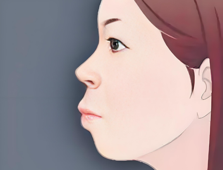 吴训医生正颌手术怎么样