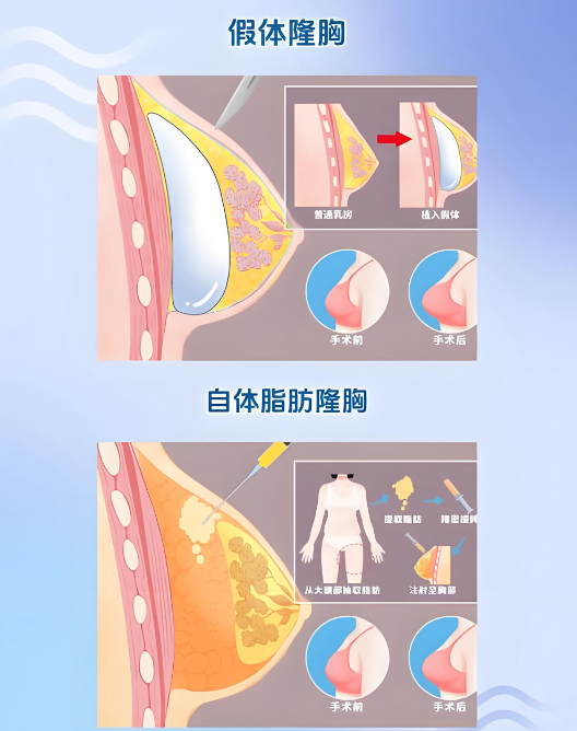 广州肖强