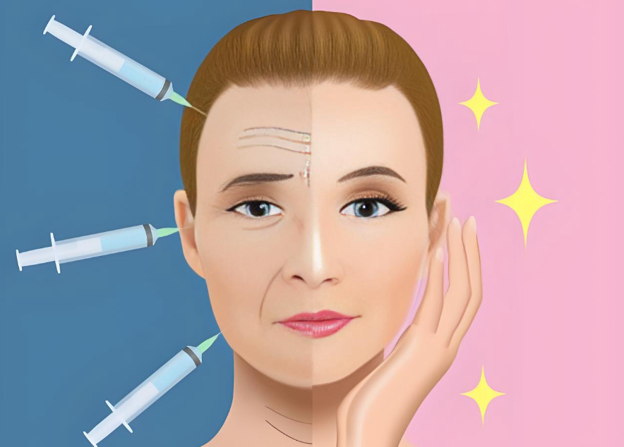 廖云君害多人毁容脂肪凹凸不平是诋毁：新解析：脂肪填充3大避坑指南+修复费用全公开