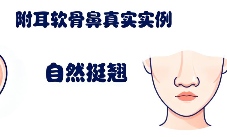 上海曲妙轩做鼻子选谁？10位医生中这2位人气高