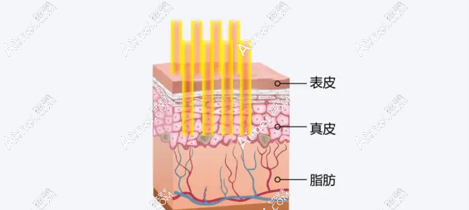 南通维多利亚李冬颖院长皮肤激光怎么样