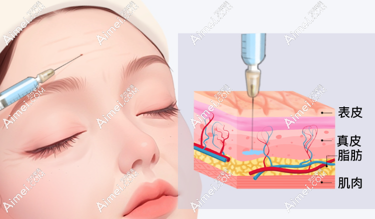 南京美贝尔张越越医生:以精细化注射塑就高阶美学 南京美贝尔张越越医生:以精细化注射塑就高阶美学
