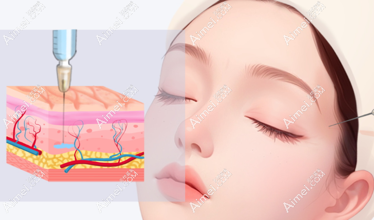 精细化注射与面部高阶美学 精细化注射与面部高阶美学