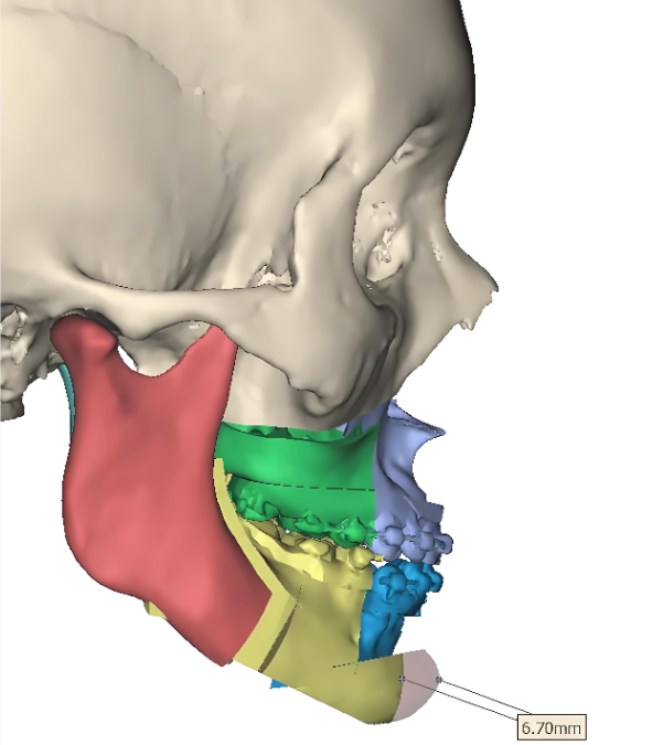 广州吴训正颌好不好