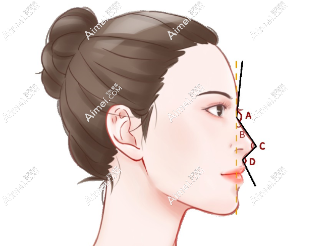 鼻畸形整复技术突破
