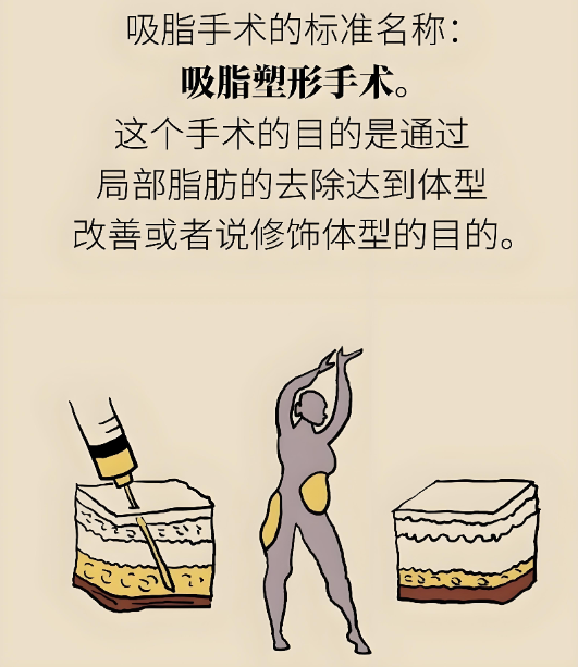 廣州郭震宇吸脂怎么樣