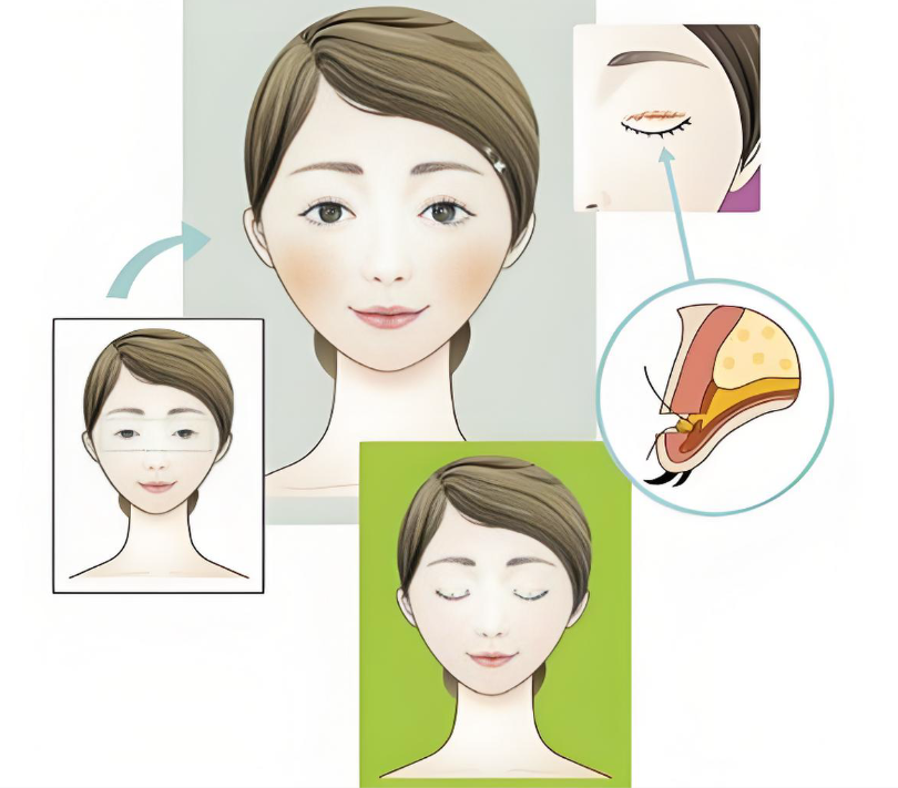 广州颜玲为何那么大