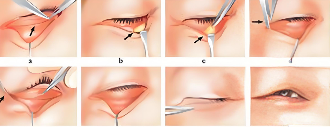 廣州顏玲和阮慶玲www.cnxhy.cn