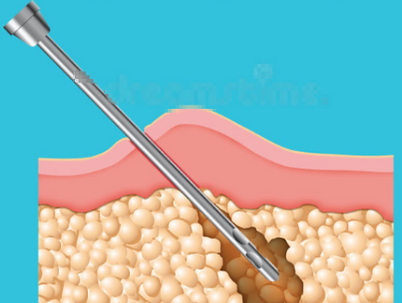 南京施尔美倪铭手术项目顾客反馈