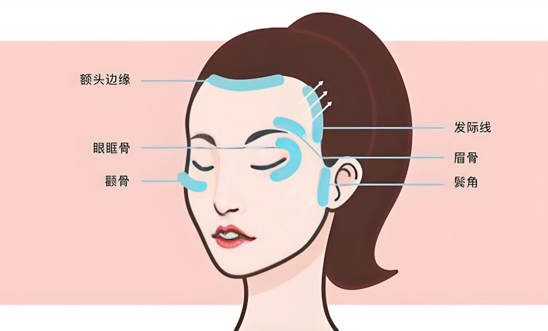 广州黄广香面部提升如何