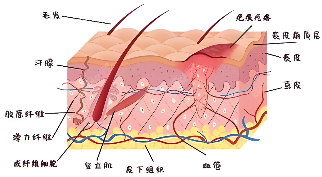 兰州维多利亚疤痕修复