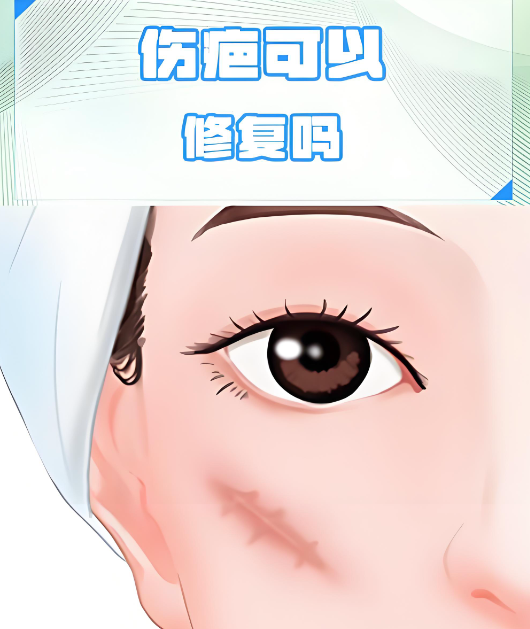 兰州维多丽亚祛疤