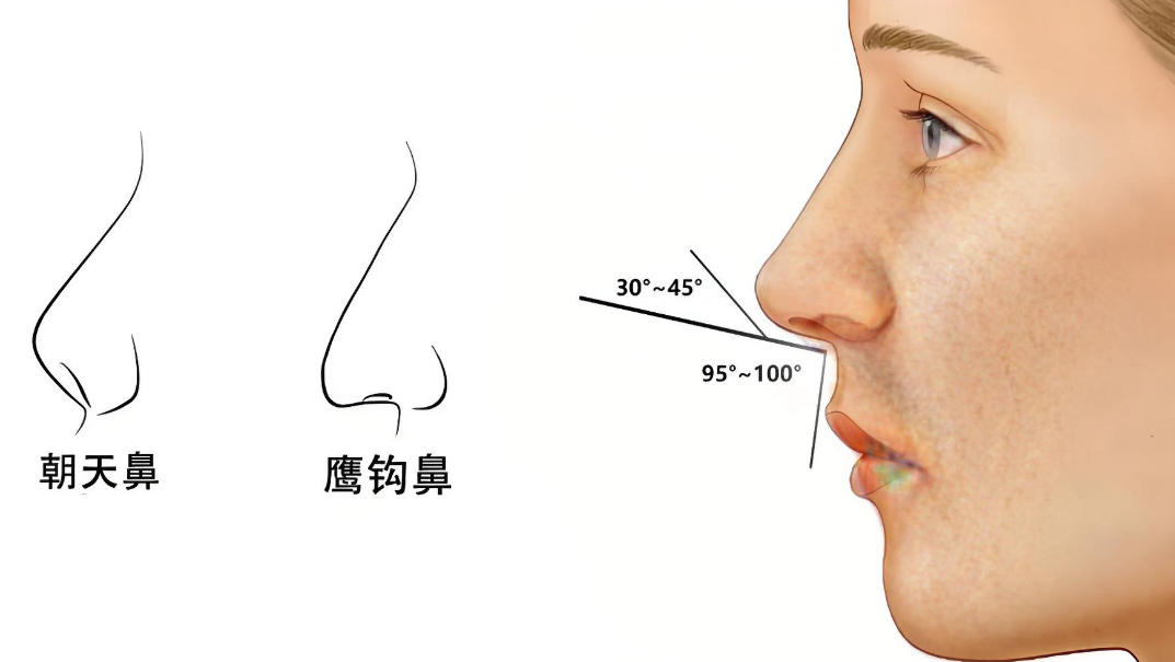 广州高顺福修复鼻子www.aimei.com