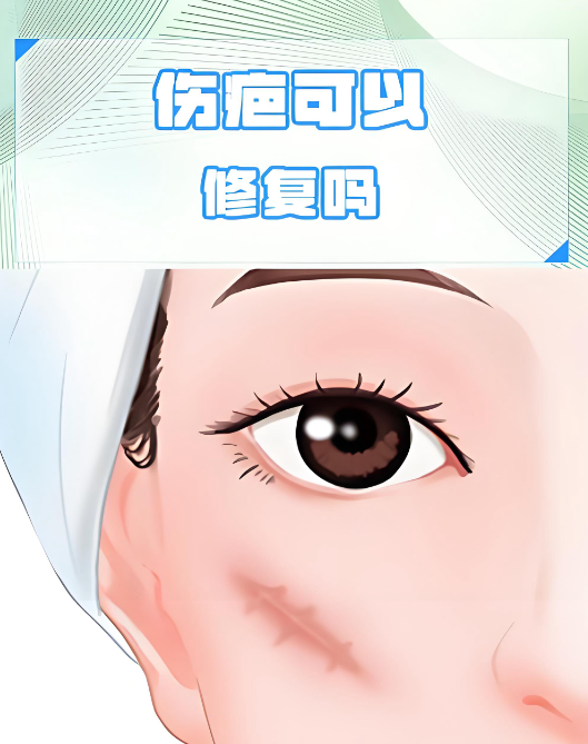 广州曙光疤痕修复靠不靠谱？我脸上这道疤被他们治得几乎看不见了，来上传一组无滤镜对比图
