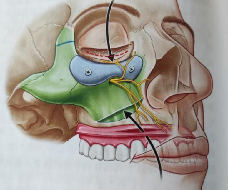 广州整形医院徐威强