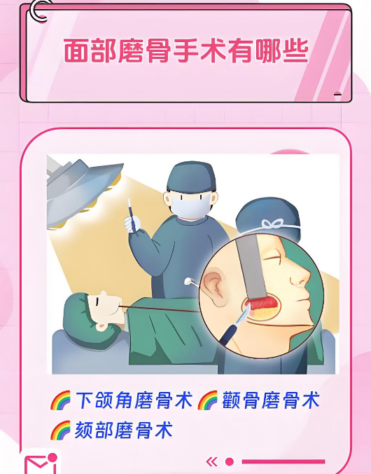 广州徐威强做改脸型实例