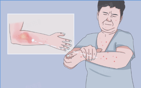 西安新城仁爱皮肤病医院