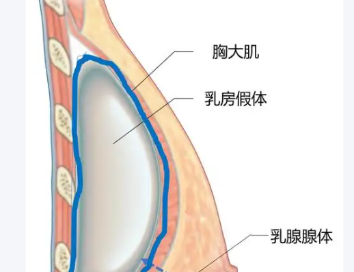 曲靖华美美莱整形美容丰胸如何？价格与消费：透明合理，避免套路