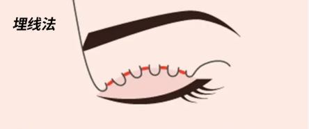 昆明汝智医疗美容怎么样?