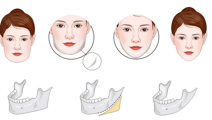 吉玟锡磨骨风格
